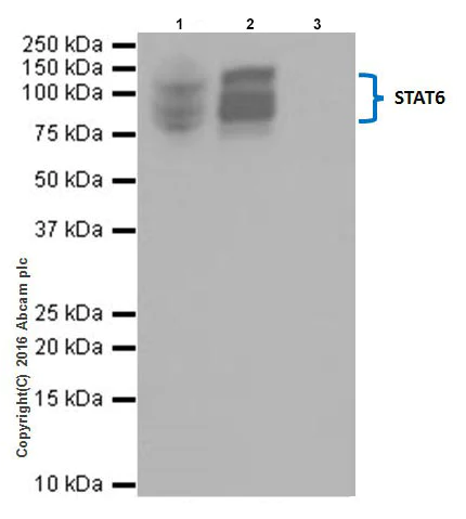 Immunoprecipitation - Anti-STAT6 antibody [EPR18278-222] - BSA and Azide free (AB251555)