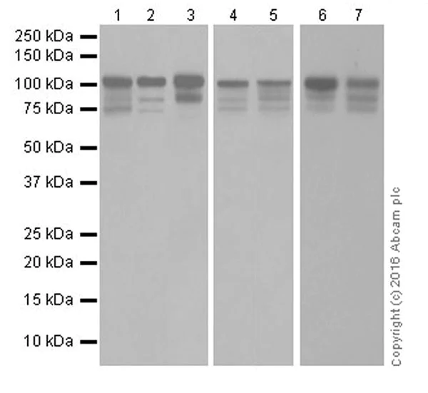 Western blot - Anti-STAT6 antibody [EPR18278-222] - BSA and Azide free (AB251555)