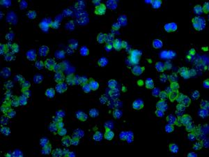 Immunocytochemistry/ Immunofluorescence - Anti-STAT6 antibody [EPR1912] (AB134940), expandable thumbnail