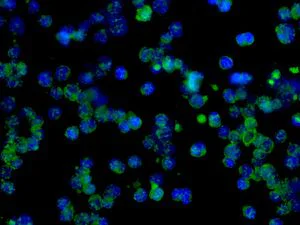 Immunocytochemistry/ Immunofluorescence - Anti-STAT6 antibody [EPR1912] (AB134940)