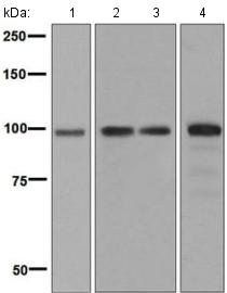 Western blot - Anti-STAT6 antibody [EPR1912] (AB134940), expandable thumbnail