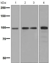 Western blot - Anti-STAT6 antibody [EPR1912] (AB134940)