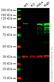 Western blot - Anti-STAT6 antibody [EPR1912] (AB134940), expandable thumbnail