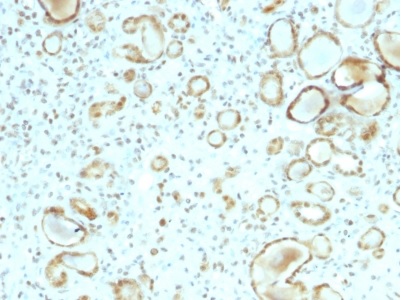 Immunohistochemistry (Formalin/PFA-fixed paraffin-embedded sections) - Anti-STAT6 antibody [STAT6/2410] - BSA and Azide free (AB237910), expandable thumbnail