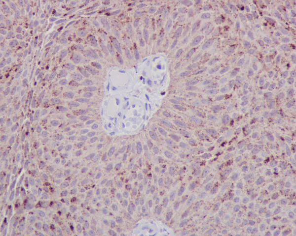 Immunohistochemistry (Formalin/PFA-fixed paraffin-embedded sections) - Anti-STAT6 antibody [YE361] (AB32520)
