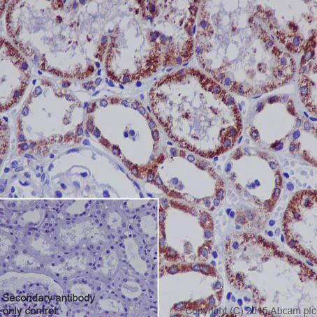 Immunohistochemistry (Formalin/PFA-fixed paraffin-embedded sections) - Anti-STAT6 antibody [YE361] (AB32520)