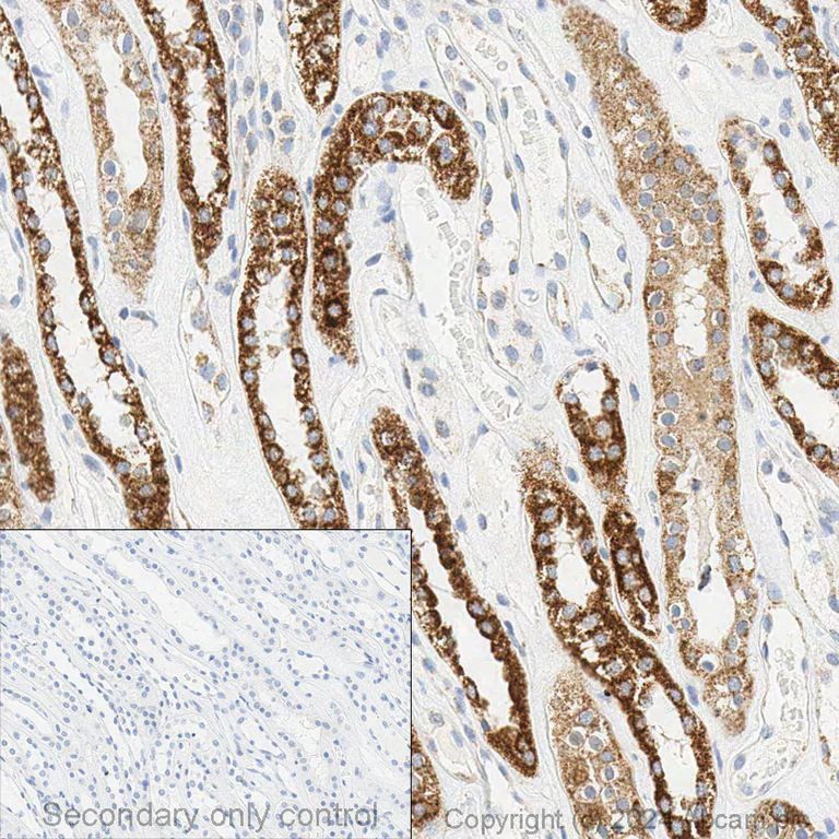 Immunohistochemistry (Formalin/PFA-fixed paraffin-embedded sections) - Anti-STAT6 antibody [YE361] (AB32520)
