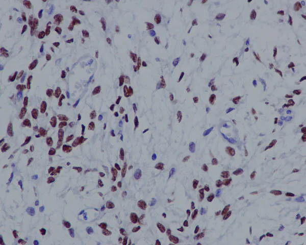 Immunohistochemistry (Formalin/PFA-fixed paraffin-embedded sections) - Anti-STAT6 antibody [YE361] (AB32520)