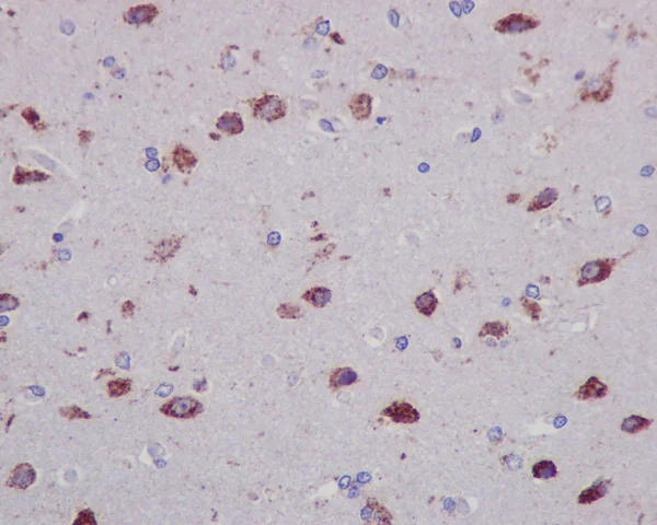 Immunohistochemistry (Formalin/PFA-fixed paraffin-embedded sections) - Anti-STAT6 antibody [YE361] (AB32520)
