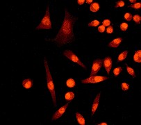 Immunocytochemistry/ Immunofluorescence - Anti-STAT6 antibody [YE361] - BSA and Azide free (ab215995), expandable thumbnail
