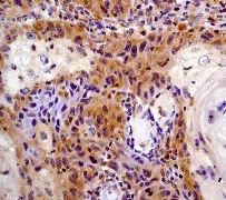Immunohistochemistry (Formalin/PFA-fixed paraffin-embedded sections) - Anti-STAT6 antibody [YE361] - BSA and Azide free (AB215995)