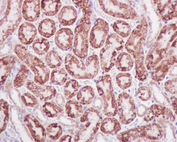 Immunohistochemistry (Formalin/PFA-fixed paraffin-embedded sections) - Anti-STAT6 antibody [YE361] - BSA and Azide free (ab215995), expandable thumbnail