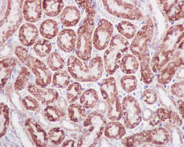 Immunohistochemistry (Formalin/PFA-fixed paraffin-embedded sections) - Anti-STAT6 antibody [YE361] - BSA and Azide free (AB215995)