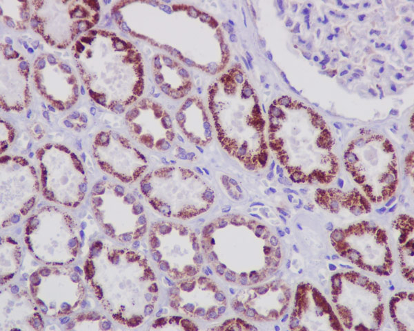 Immunohistochemistry (Formalin/PFA-fixed paraffin-embedded sections) - Anti-STAT6 antibody [YE361] - BSA and Azide free (ab215995), expandable thumbnail