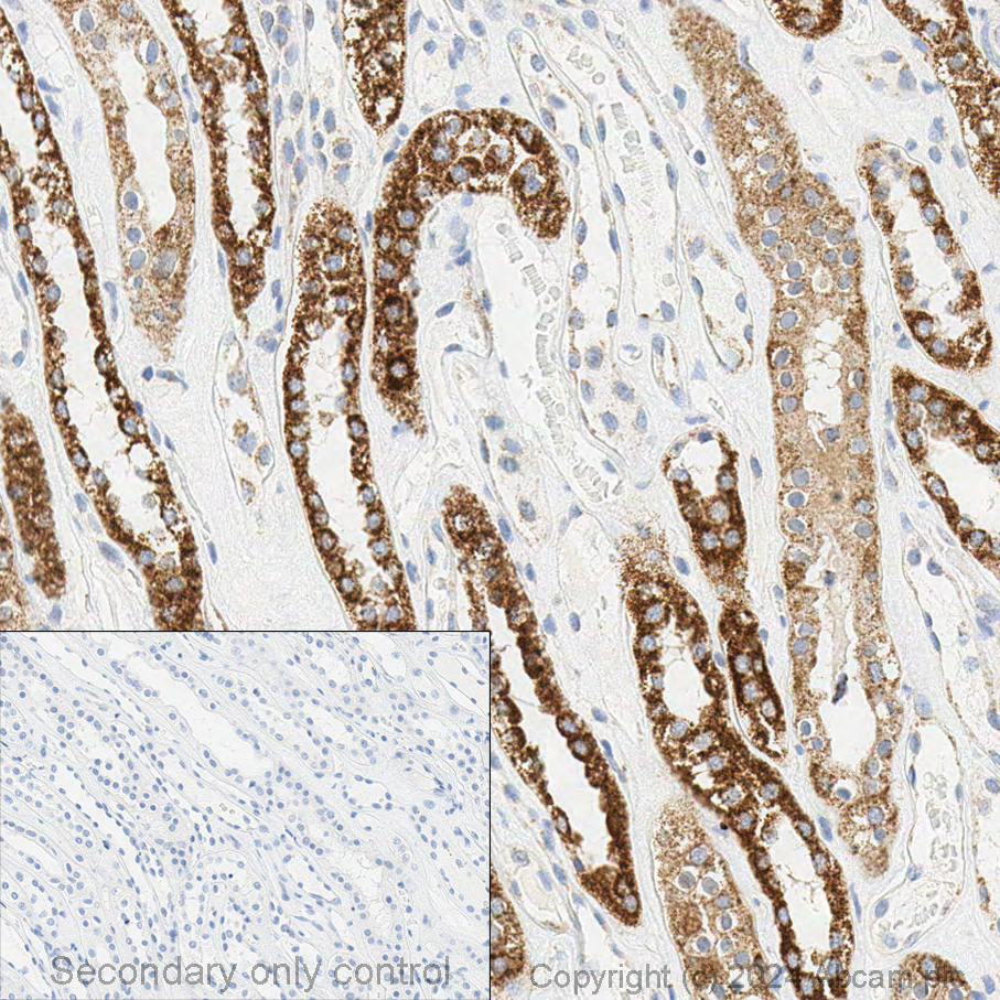 Immunohistochemistry (Formalin/PFA-fixed paraffin-embedded sections) - Anti-STAT6 antibody [YE361] - BSA and Azide free (ab215995), expandable thumbnail