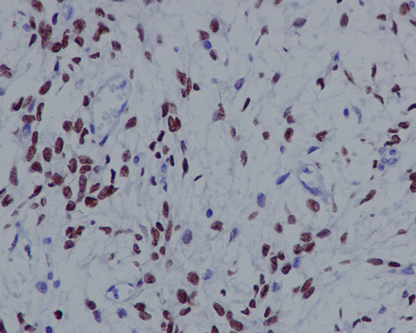 Immunohistochemistry (Formalin/PFA-fixed paraffin-embedded sections) - Anti-STAT6 antibody [YE361] - BSA and Azide free (ab215995), expandable thumbnail