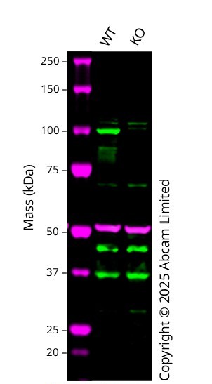 Western blot - Anti-STAT6 antibody [YE361] - BSA and Azide free (ab215995), expandable thumbnail