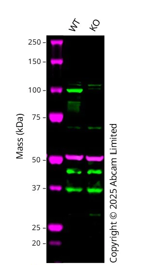 Western blot - Anti-STAT6 antibody [YE361] - BSA and Azide free (AB215995)