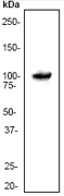 Western blot - Anti-STAT6 antibody [YE361] - BSA and Azide free (ab215995), expandable thumbnail