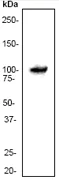 Western blot - Anti-STAT6 antibody [YE361] - BSA and Azide free (AB215995)