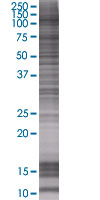 SDS-PAGE - STAT6 overexpression 293T lysate (whole cell) (AB94186), expandable thumbnail