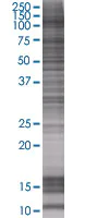 SDS-PAGE - STAT6 overexpression 293T lysate (whole cell) (AB94186)