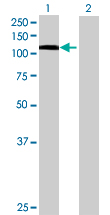 Western blot - STAT6 overexpression 293T lysate (whole cell) (AB94186), expandable thumbnail