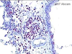 Immunohistochemistry (Formalin/PFA-fixed paraffin-embedded sections) - Anti-STAT6 (phospho Y641) antibody (AB28829)