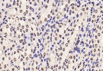 Immunohistochemistry (Formalin/PFA-fixed paraffin-embedded sections) - Anti-STAT6 (phospho Y641) antibody (AB28829)