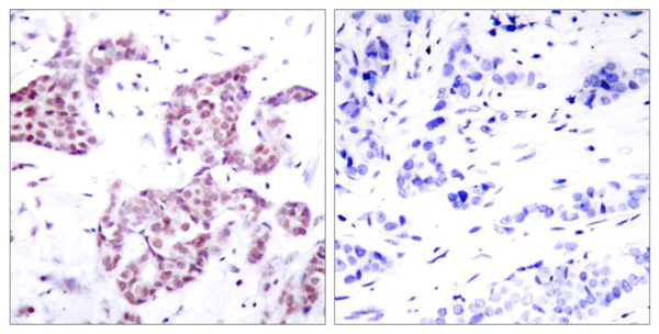 Immunohistochemistry (Formalin/PFA-fixed paraffin-embedded sections) - Anti-STAT6 (phospho Y641) antibody (AB28829)
