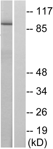 Western blot - Anti-STAT6 (phospho Y641) antibody (AB28829)