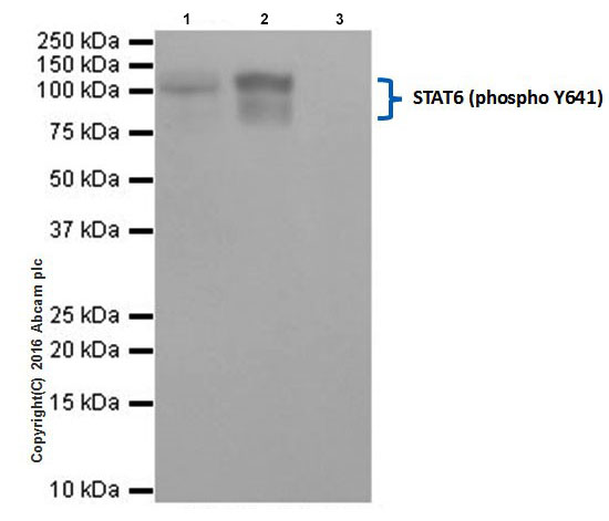 Immunoprecipitation - Anti-STAT6 (phospho Y641) antibody [EPR18278-265] (AB188080), expandable thumbnail