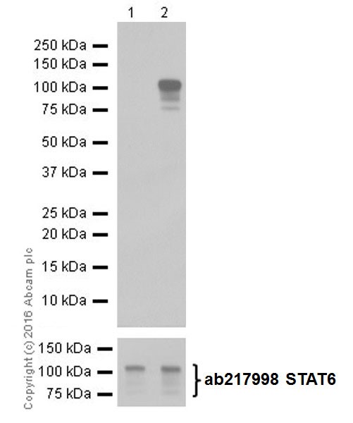 Western blot - Anti-STAT6 (phospho Y641) antibody [EPR18278-265] (AB188080), expandable thumbnail