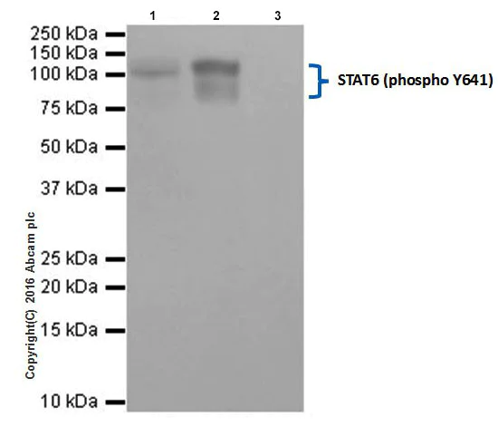 Immunoprecipitation - Anti-STAT6 (phospho Y641) antibody [EPR18278-265] - BSA and Azide free (AB223128)