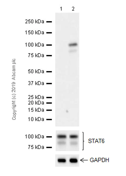 Anti-STAT6 (phospho Y641) antibody [EPR22599-78] (ab263947