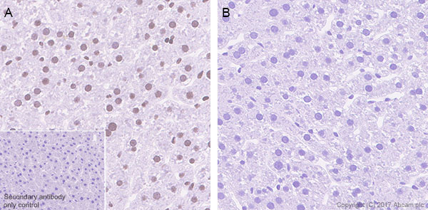 Immunohistochemistry (Formalin/PFA-fixed paraffin-embedded sections) - Anti-STAT6 (phospho Y641) antibody [EPR22599-78] - BSA and Azide free (AB263950), expandable thumbnail