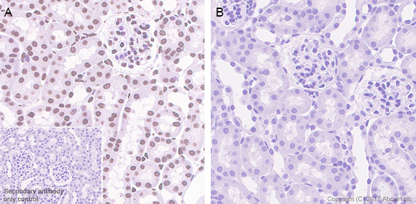 Immunohistochemistry (Formalin/PFA-fixed paraffin-embedded sections) - Anti-STAT6 (phospho Y641) antibody [EPR22599-78] - BSA and Azide free (ab263950), expandable thumbnail