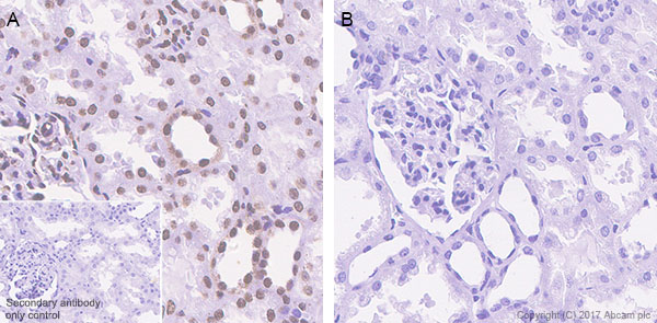 Immunohistochemistry (Formalin/PFA-fixed paraffin-embedded sections) - Anti-STAT6 (phospho Y641) antibody [EPR22599-78] - BSA and Azide free (AB263950), expandable thumbnail