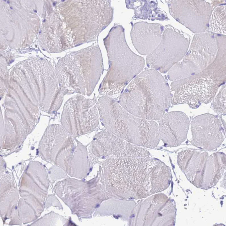 Immunohistochemistry (Formalin/PFA-fixed paraffin-embedded sections) - Anti-Statherin antibody (AB254889)