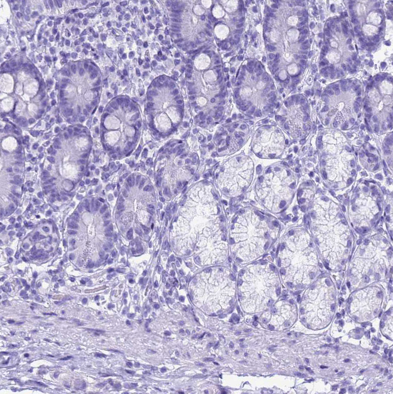 Immunohistochemistry (Formalin/PFA-fixed paraffin-embedded sections) - Anti-Statherin antibody (AB254889)
