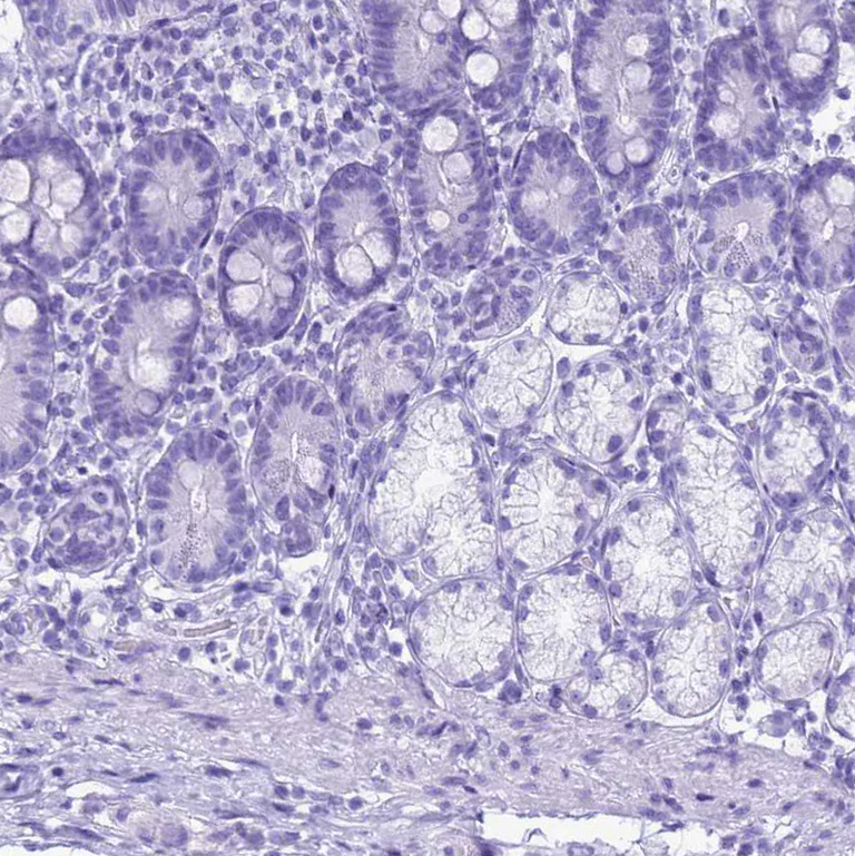 Immunohistochemistry (Formalin/PFA-fixed paraffin-embedded sections) - Anti-Statherin antibody (AB254889)