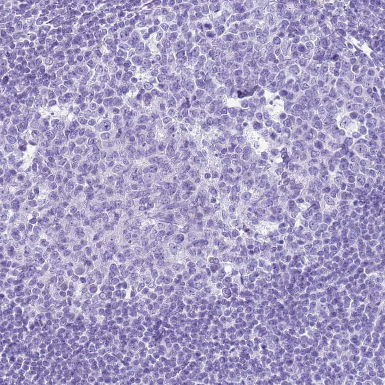 Immunohistochemistry (Formalin/PFA-fixed paraffin-embedded sections) - Anti-Statherin antibody (AB254889)