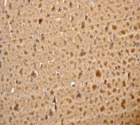Immunohistochemistry (Formalin/PFA-fixed paraffin-embedded sections) - Anti-Stathmin 1 antibody [EP1572] (AB119991)
