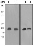 Anti-Stathmin 1 antibody [EP1572]