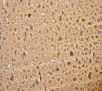 Immunohistochemistry (Formalin/PFA-fixed paraffin-embedded sections) - Anti-Stathmin 1 antibody [EP1572] - BSA and Azide free (AB284789)