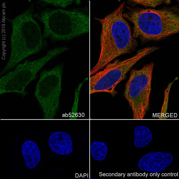 Immunocytochemistry/ Immunofluorescence - Anti-Stathmin 1 antibody [EP1573Y] (AB52630)