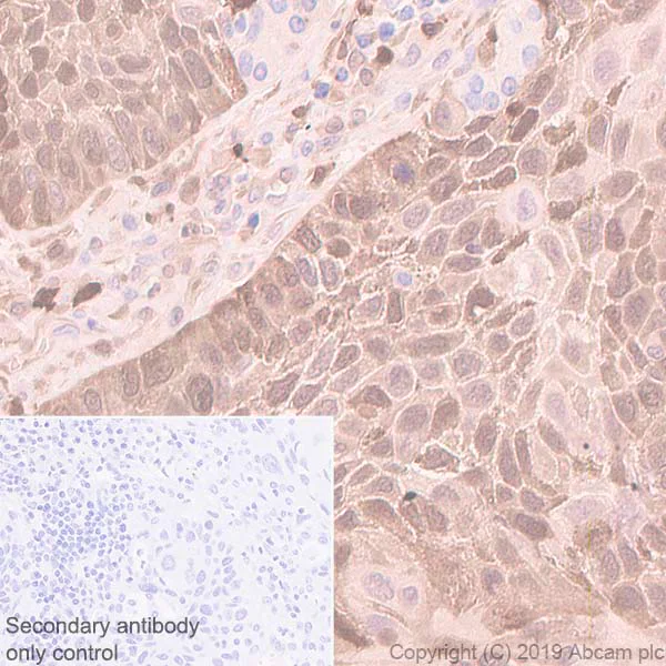 Anti-Stathmin 1 antibody [EP1573Y] (ab52630) | Abcam