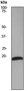 Western blot - Anti-Stathmin 1 antibody [EP1573Y] (AB52630)