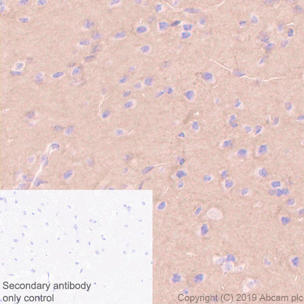 Immunohistochemistry (Formalin/PFA-fixed paraffin-embedded sections) - Anti-Stathmin 1 antibody [EP1573Y] - BSA and Azide free (AB221017)