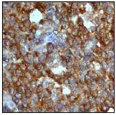 Immunohistochemistry (Formalin/PFA-fixed paraffin-embedded sections) - Anti-Stathmin 1 antibody [EP1573Y] - BSA and Azide free (AB221017)